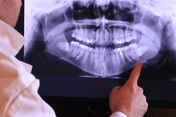 Best Emergency Tooth Extraction in Ellaville, GA